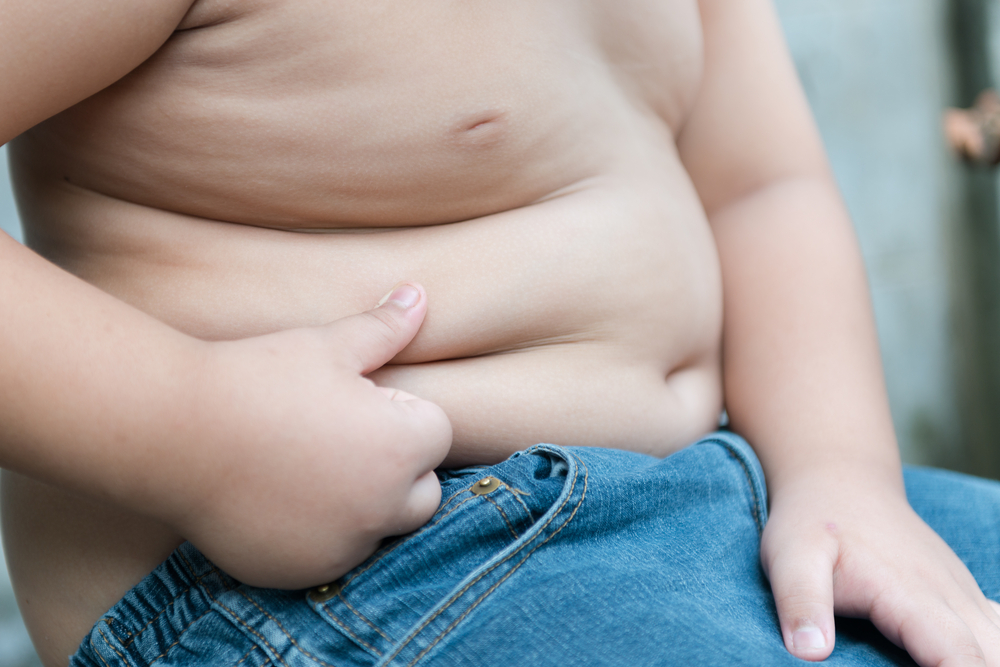 gojaznost kod dece