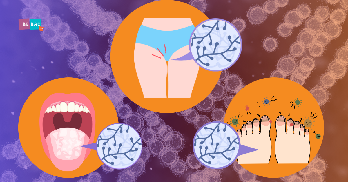 kandidom zahvaćena usna duplja, vaginalna flora i stopala