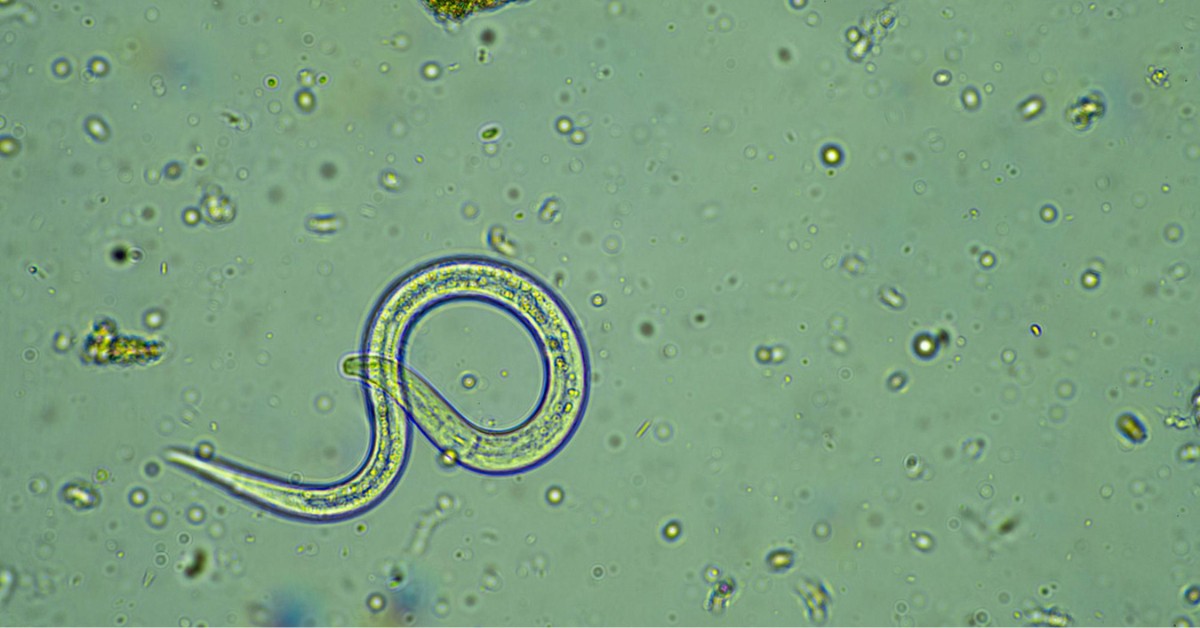 mikroskopski prikaz dečije gliste