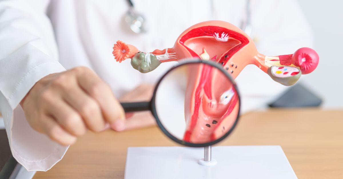 Doktor pokazuje model materice