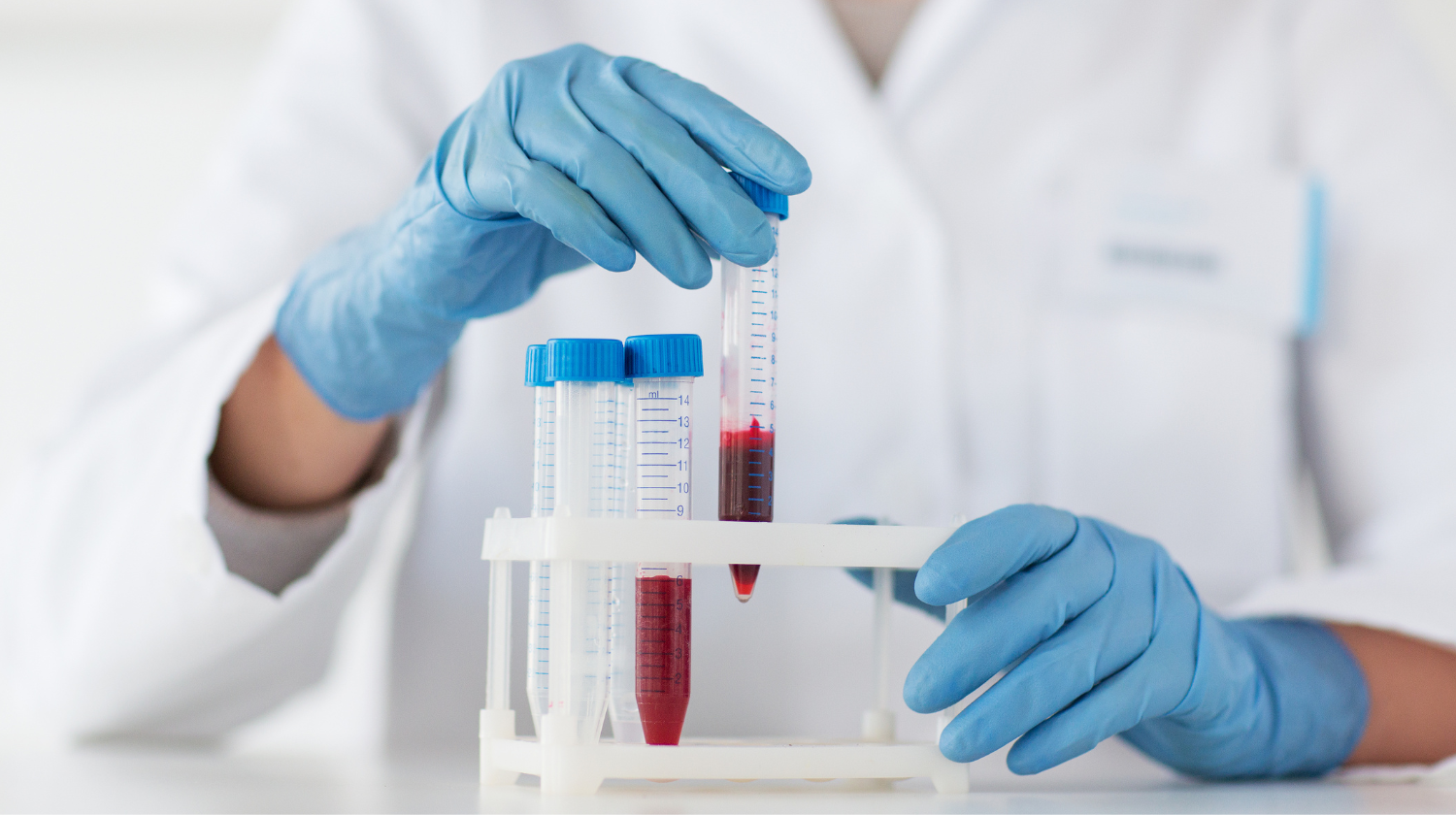 Laboratorijski testovi krvi