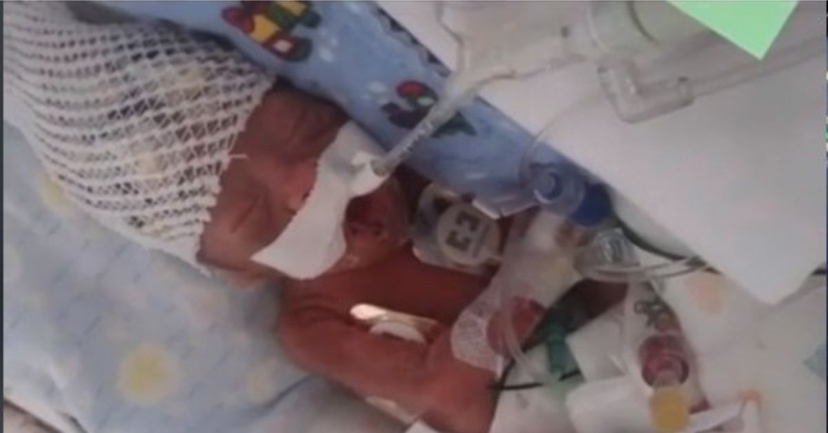 Mala prevremeno rođena beba Džejden