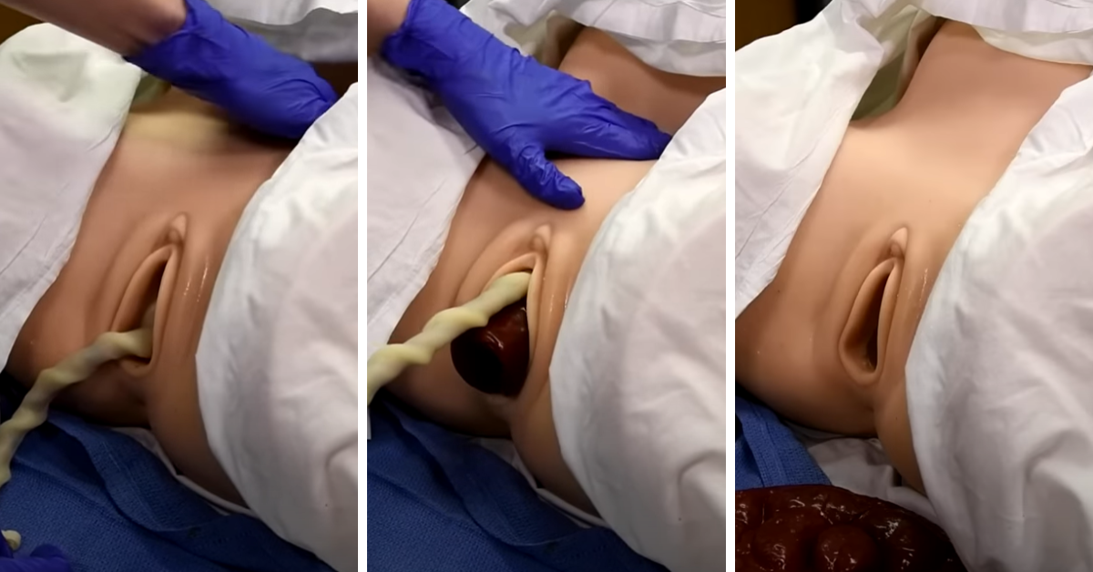 izbacivanje placente prikazano na lutki