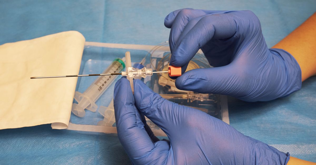 epiduralna anestezija