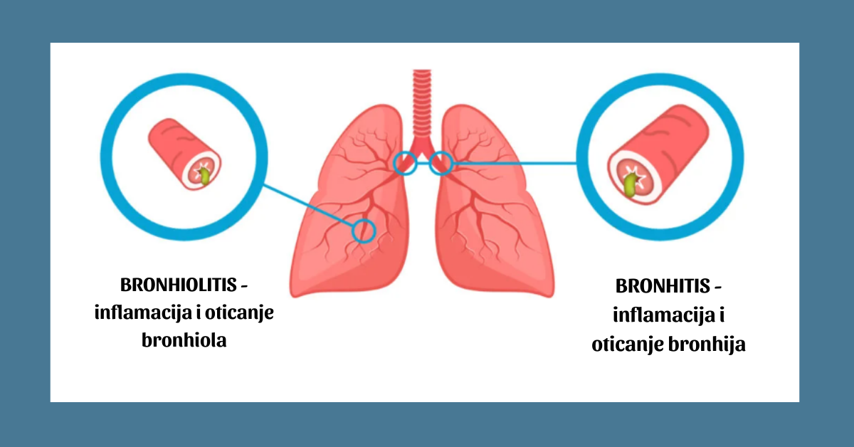 Bronhitis, pluća