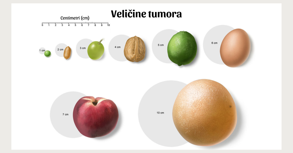 veličine tumora dojke predstavljene voćem i mahunarkama