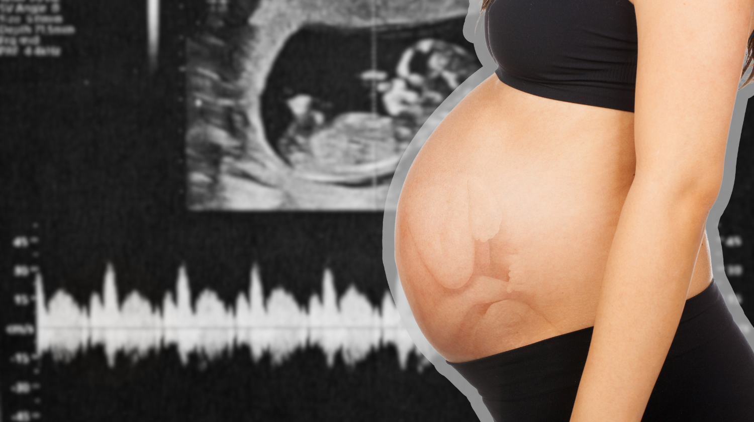 Pokreti bebe u stomaku