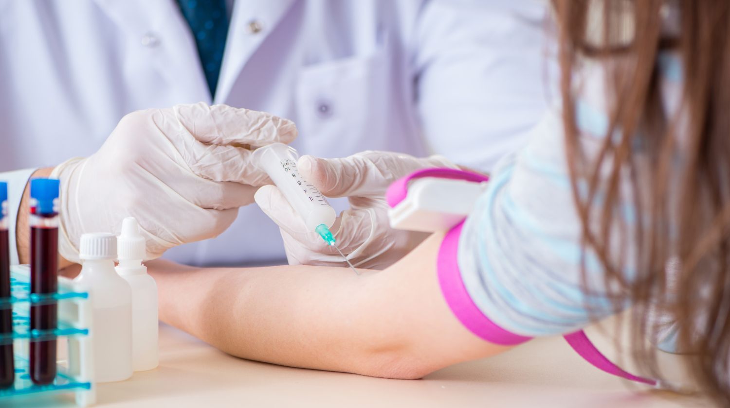 Vadjenje krvi iz vene