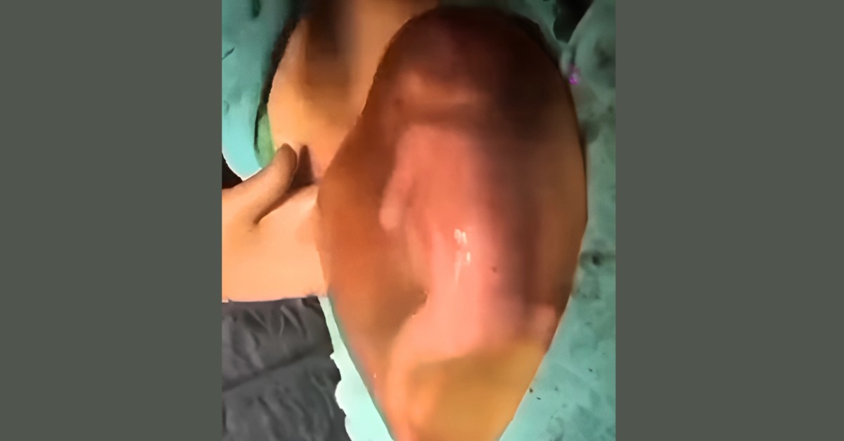 beba u amnionskoj tečnosti