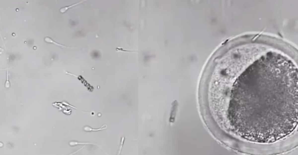 Oplodnja jajne ćelije uz pomoć spermatozoida sa mikromotorom