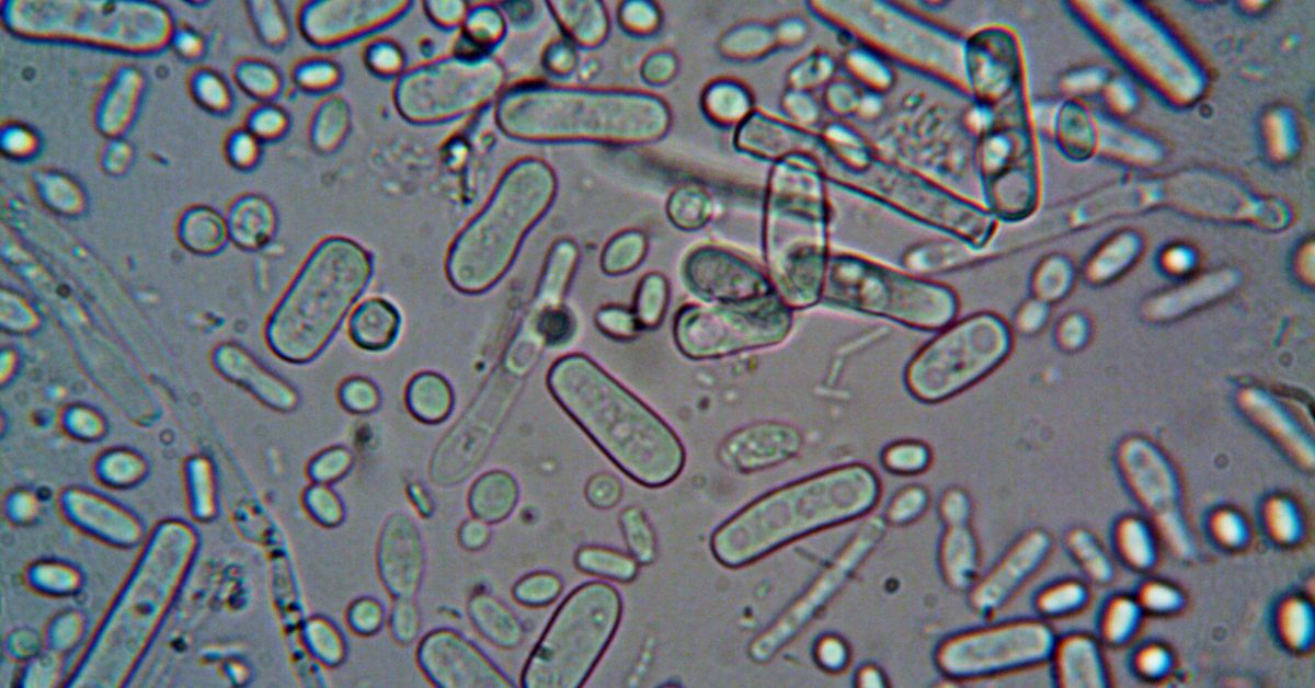 Bakterije uveličane da budu vidljive golim okom