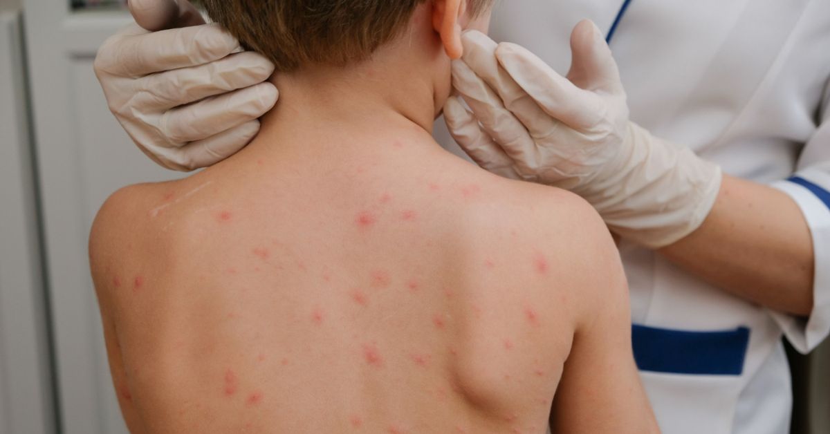 Dečak boginje poseta lekaru