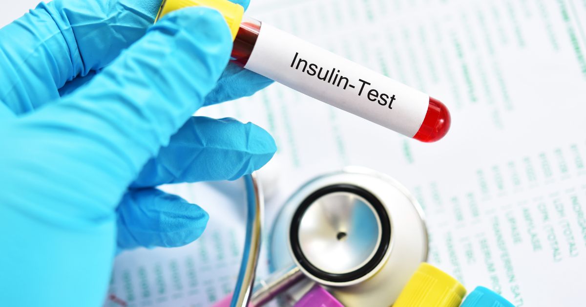 Ruka lekar epruveta test insulin