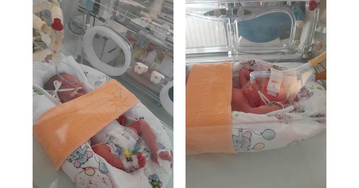 Prevremeno rođene bebe