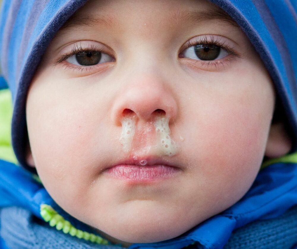 Malo dete cure sline iz nosa