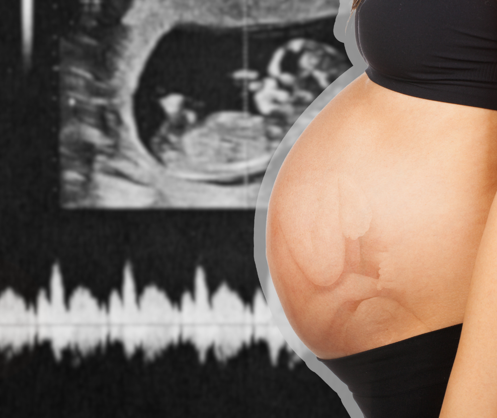 Pokreti bebe u stomaku