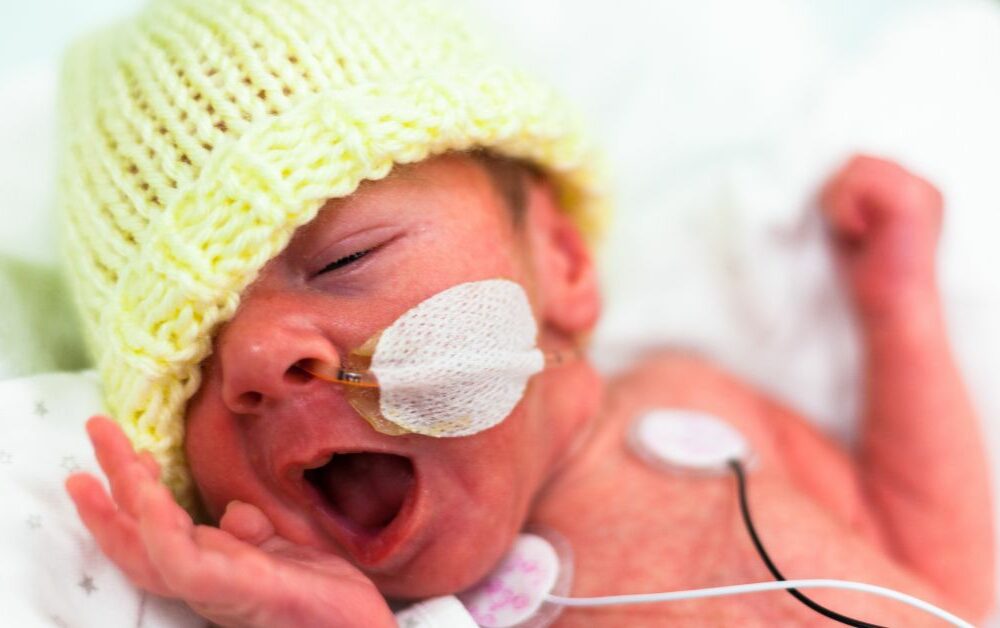 Fotografija prevremeno rođene bebe sa žutom kapicom