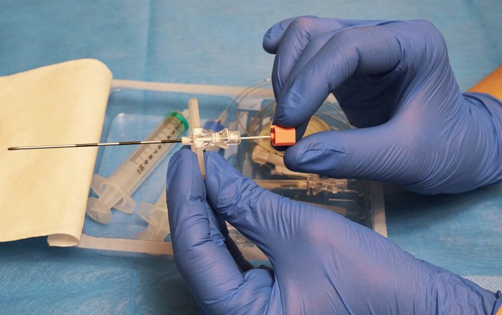 epiduralna anestezija